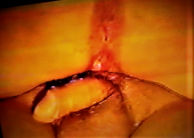 Semen Oozing, 2 .png