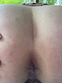 Ass Hairy.jpg