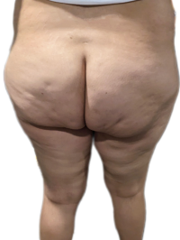 BackgroundEraser_20240623_083555154.png