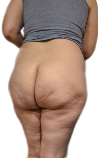 BackgroundEraser_20250401_022651017_1.png