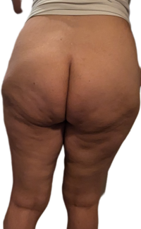 BackgroundEraser_20250209_014403401.png