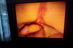 VID_0522 - frame at 9m10s.jpg