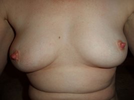 Nips.JPG