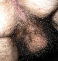 Hairy_balls_ 1.jpg