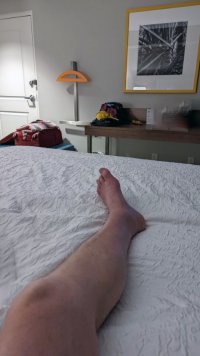 RonsLeg-(Small).jpg