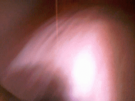 lillann facial 3.gif