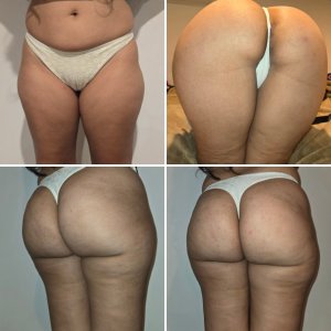 Yhwife swimsuit thong