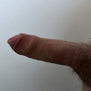 My Uncut Cock