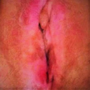Self Aroused, now needing U