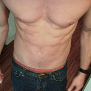 Chest