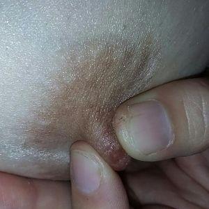nipple pinch